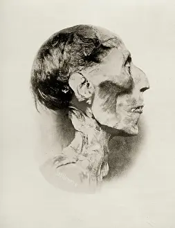 Mummified: Mummified head of Egyptian Pharaoh, Ramses II