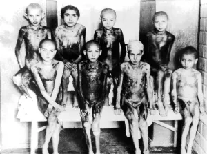 Emaciated: Nazi Medical Experiments
