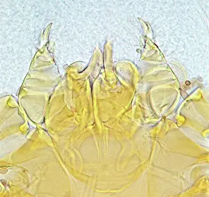 Scratching: Neotrombicula autumnalis, harvest mite