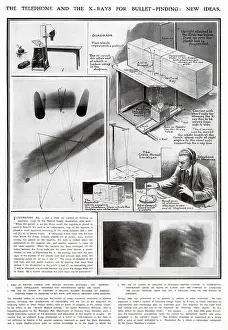 Examinations: New Ideas for using X-Rays for Medical use WWI