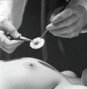 Achurch: Nipple radio transmitter for use in spying