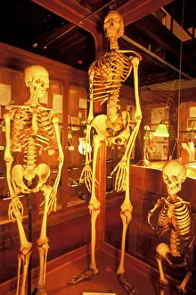 Mutter: Normal giant and dwarf human skeletons on display