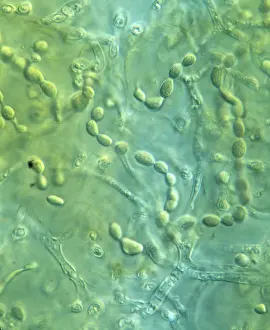 Bacteria: Nostoc sp