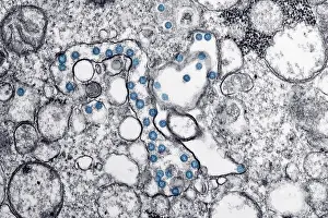 Virion: Novel Coronavirus SARS-CoV-2, also called