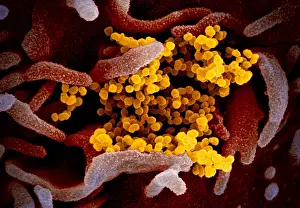 Virion: Novel Coronavirus SARS-CoV-2, causes coronavirus