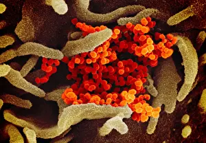 Virion: Novel Coronavirus SARS-CoV-2, causes coronavirus