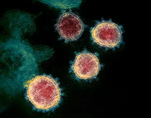 Virion: Novel Coronavirus SARS-CoV-2, causes coronavirus