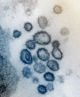 Virion: Novel Coronavirus SARS-CoV-2, causes coronavirus