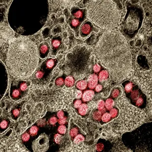 Sars: Novel Coronavirus SARS-CoV-2, the virus that causes