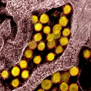 Sars: Novel Coronavirus SARS-CoV-2, the virus that causes