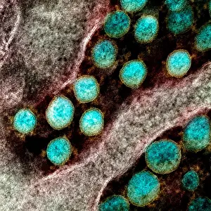 Sars: Novel Coronavirus SARS-CoV-2, the virus that causes