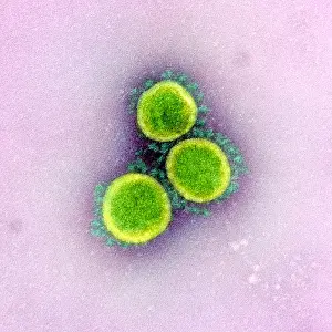 Sars: Novel Coronavirus SARS-CoV-2, the virus that causes