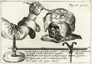 Trepanning: OPERATION ON SKULL