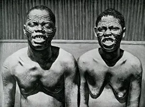 Scar: Ornamental scars on face and sharpened and filed teeth