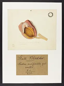 Portion: Ossification of the Gall Bladder