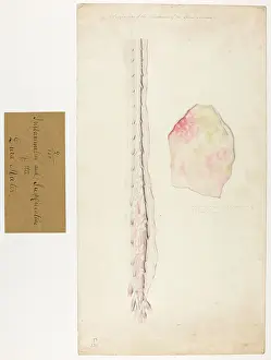 1827: Ossification of Spinal Marrow