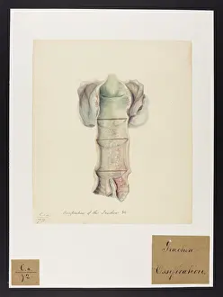 Ucl Library Services Digital Collections: Ossification of the Trachea