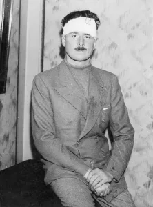 Mosley: Oswald Mosley with a bandage round his head