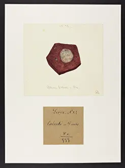 1829: Ox: Biliary Calculi