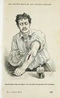 Antiseptic: Painting a wound with an antiseptic solution