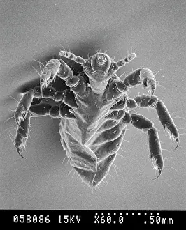 Lice: Pediculus humanus, human head louse