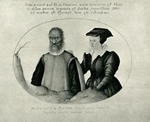 Gonzales: Pedro Gonzalez, the hairy man