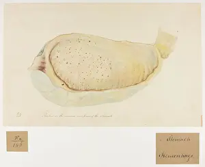 Stomach: Petechia on the Mucous Membrane of the Stomach