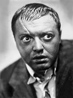 Scar: Peter Lorre
