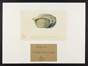 Stomach: Petichia of the Mucous Membrane of the Stomach