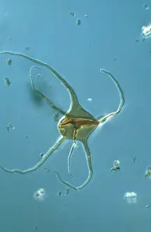 Silurian: Photomicrograph: Acanthomorph acritarch, microfossil