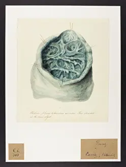 Ucl Library Services Digital Collections: Phthisis