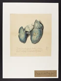 Plantes: Phthisis Pulmonalis in a Monkey