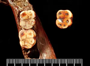 Forgery: Piltdown 1 jaw with Piltdown 2 molar