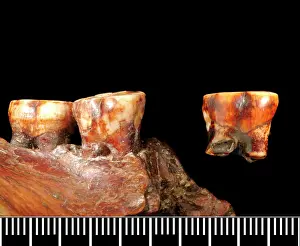Forgery: Piltdown 1 jaw with Piltdown 2 molar