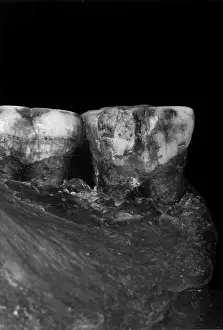 Forgery: Piltdown 1 molars