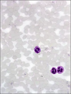 Protozoan: Plasmodium sp. malarial parasite