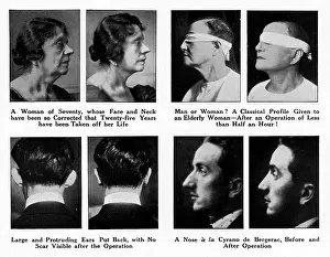 Profiles: Plastic Surgery - Before and After