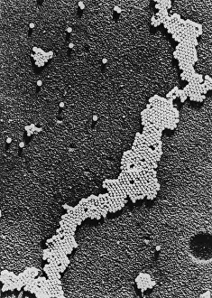 Infantile: Polio (Poliomyelitis) virus, the cause of ?