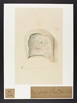 1826: Portion of Bladder