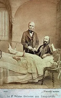 Amputated: Portrait of dr. Nelaton and