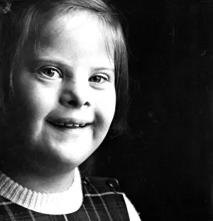 Syndrome: Portrait girl with downs smiles to camera