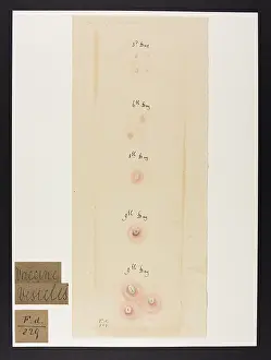 Blank: Progress of Vaccine Vesicles