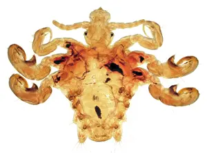 Infestation: Pthirus pubis, crab louse