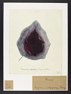 Pulmonary: Pulmonary Apoplexy