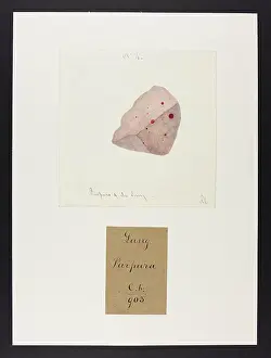 Lungs: Purpura of the Lungs