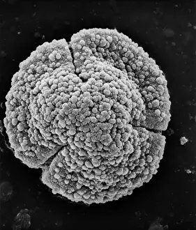 Pollen: Quercus robur, English oak