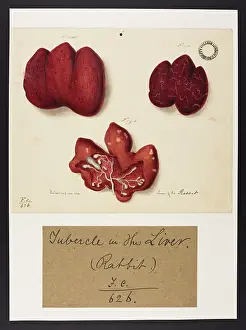 Liver: Rabbit: Tubercle in the Liver