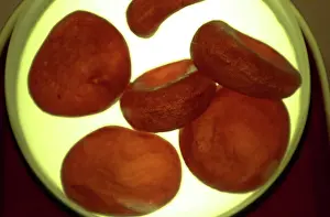 Anaemia: Red blood cells