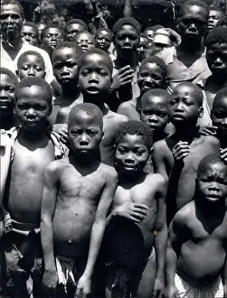 Malnutrition: Refugees