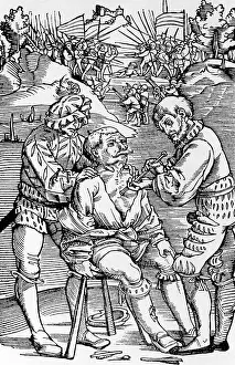 Removal: Removal of an arrow, 1528
